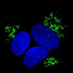 Rabbit IgG (H+L) Highly Cross-Adsorbed Secondary Antibody in Immunocytochemistry (ICC/IF)