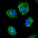 Rabbit IgG (H+L) Highly Cross-Adsorbed Secondary Antibody in Immunocytochemistry (ICC/IF)