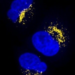 Rabbit IgG (H+L) Highly Cross-Adsorbed Secondary Antibody in Immunocytochemistry (ICC/IF)