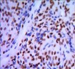 GATA1 Antibody in Immunohistochemistry (Paraffin) (IHC (P))