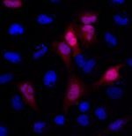 GFP Antibody in Immunocytochemistry (ICC/IF)