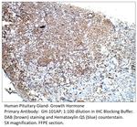 Growth Hormone Antibody in Immunohistochemistry (IHC)