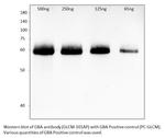 GBA Antibody in Western Blot (WB)