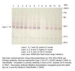 Glucose Transporter GLUT1 Antibody in Western Blot (WB)