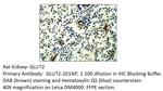 Glucose Transporter GLUT2 Antibody in Immunohistochemistry (IHC)