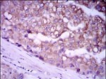 Glypican 3 Antibody in Immunohistochemistry (Paraffin) (IHC (P))