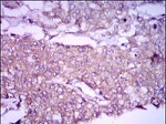 Glypican 3 Antibody in Immunohistochemistry (Paraffin) (IHC (P))