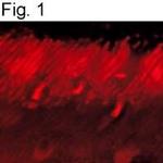 GRK1 Antibody in Immunohistochemistry (IHC)