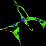 GRK2 Antibody in Immunocytochemistry (ICC/IF)