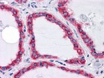 GRP78 Antibody in Immunohistochemistry (Paraffin) (IHC (P))