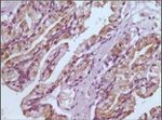 GSTP1 Antibody in Immunohistochemistry (Paraffin) (IHC (P))