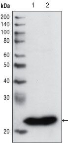 GSTP1 Antibody in Western Blot (WB)