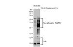 Phospho-Tau (Thr217) Antibody in Western Blot (WB)