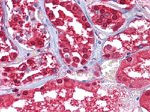 GPI Antibody in Immunohistochemistry (Paraffin) (IHC (P))