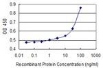 A2M Antibody in ELISA (ELISA)