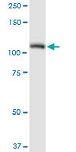 AARS Antibody in Western Blot (WB)