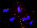 ABL2 Antibody in Proximity Ligation Assay (PLA) (PLA)