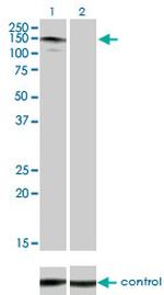 ABL2 Antibody in Western Blot (WB)