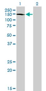 ABL2 Antibody in Western Blot (WB)