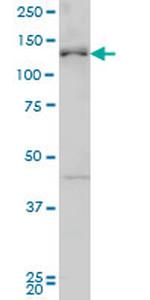 ABL2 Antibody in Western Blot (WB)