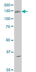 ABL2 Antibody in Western Blot (WB)