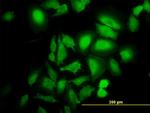 ABL2 Antibody in Immunocytochemistry (ICC/IF)