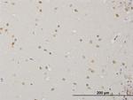 ABL2 Antibody in Immunohistochemistry (Paraffin) (IHC (P))