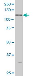 ABL2 Antibody in Western Blot (WB)