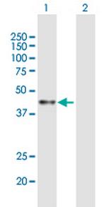 ACAA1 Antibody in Western Blot (WB)