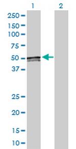 ACAA1 Antibody in Western Blot (WB)