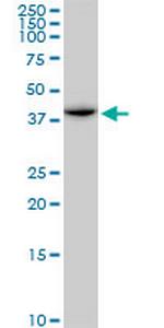 ACADM Antibody in Western Blot (WB)