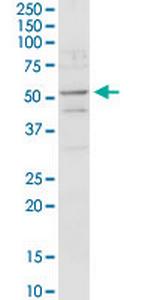 ACADM Antibody in Western Blot (WB)