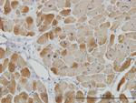 ACADVL Antibody in Immunohistochemistry (Paraffin) (IHC (P))