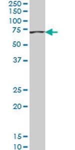 ACADVL Antibody in Western Blot (WB)