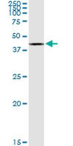 ACAT2 Antibody in Western Blot (WB)