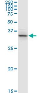 ACAT2 Antibody in Western Blot (WB)