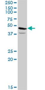 ACAT2 Antibody in Western Blot (WB)