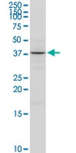 ACAT2 Antibody in Western Blot (WB)