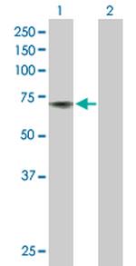 ACHE Antibody in Western Blot (WB)