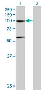 ACO1 Antibody in Western Blot (WB)