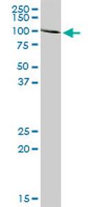 ACO1 Antibody in Western Blot (WB)