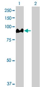 ACO1 Antibody in Western Blot (WB)