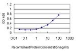 ACO1 Antibody in ELISA (ELISA)