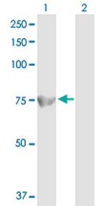 ACOX1 Antibody in Western Blot (WB)