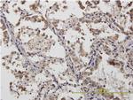 ACTN4 Antibody in Immunohistochemistry (Paraffin) (IHC (P))