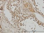 ACTN4 Antibody in Immunohistochemistry (Paraffin) (IHC (P))