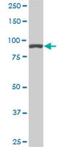 ACTN4 Antibody in Western Blot (WB)