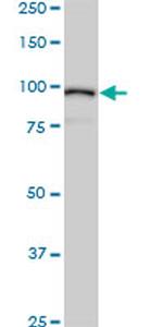 ACTN4 Antibody in Western Blot (WB)