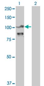 ACTN4 Antibody in Western Blot (WB)