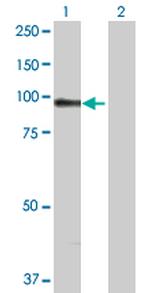 ACTN1 Antibody in Western Blot (WB)